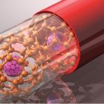 نانوداروی ایرانی برای کاهش دردهای میگرنی ثبت بین‌المللی شد